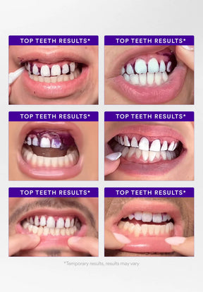 TitanWhite – Stain V34 Treatment Whitening Strips