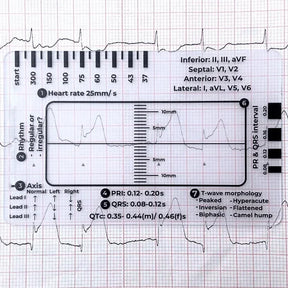 MediTrack – Professional ECG Assessment Pocket Guide