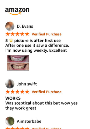 TitanWhite – Stain V34 Treatment Whitening Strips