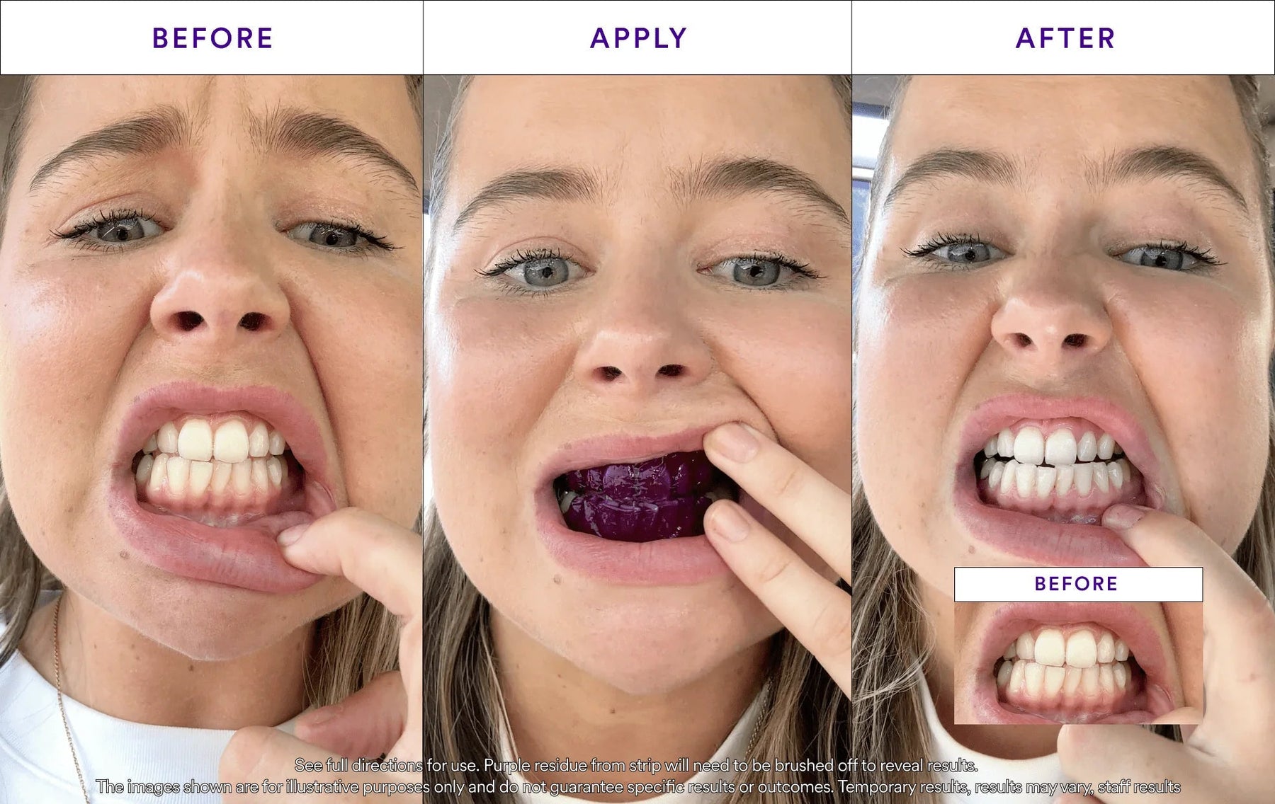 TitanWhite – Stain V34 Treatment Whitening Strips