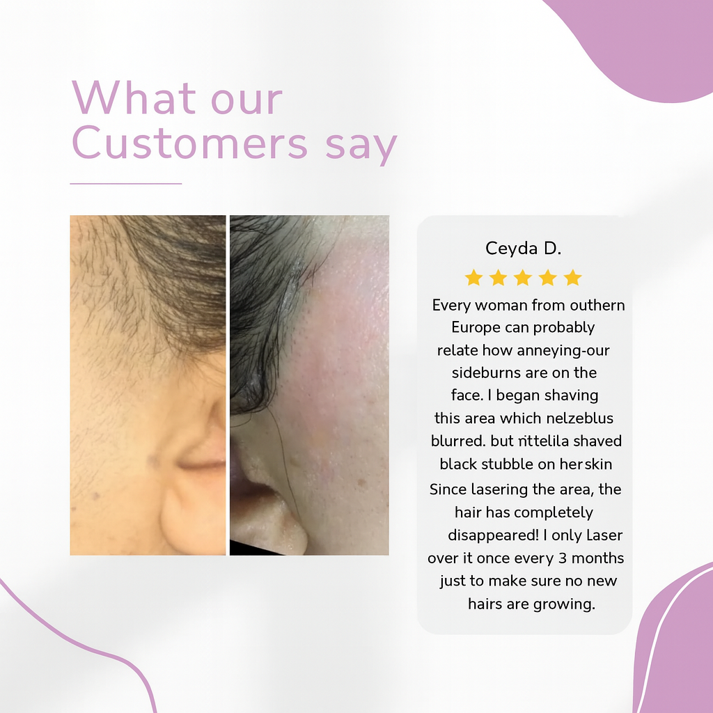 GlowEase - IPL Hair Remover for Effortless Smooth Skin