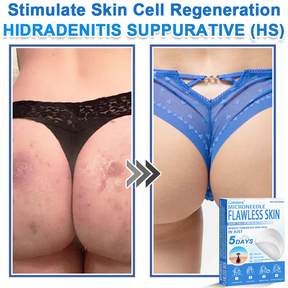 GlowSkin -  2-in-1 Microneedle & Hydrocolloid Star Patch