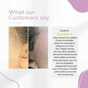 GlowEase - IPL Hair Remover for Effortless Smooth Skin