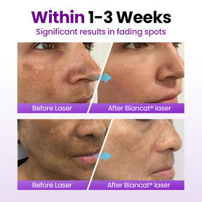 PureRadiance – Probiotic Brightening Face Serum With SPF Protection