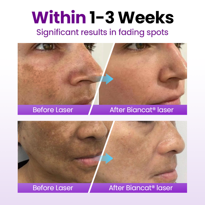 PureRadiance – Probiotic Brightening Face Serum With SPF Protection