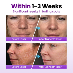 PureRadiance – Probiotic Brightening Face Serum With SPF Protection