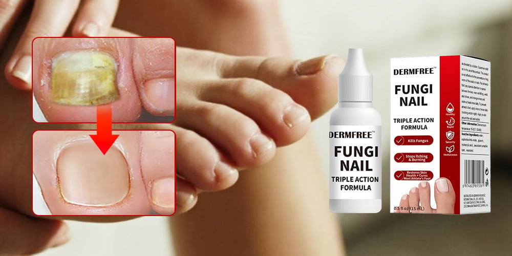 PureRoot – Extra Strength Toenail Treatment