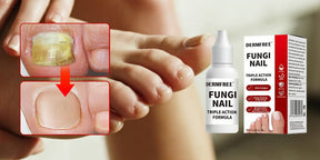 PureRoot – Extra Strength Toenail Treatment