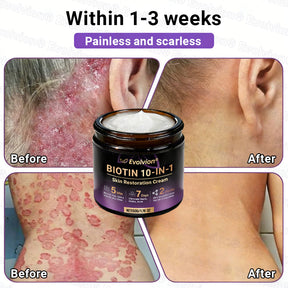 DermaVive – Biotin 10-in-1 Skin Restoration Cream