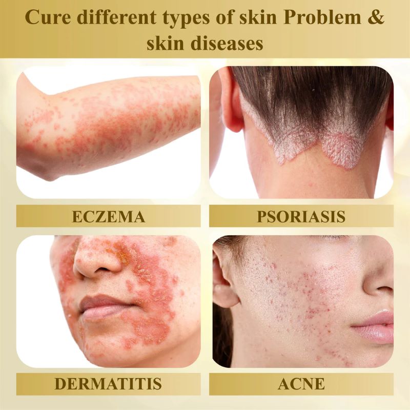 DermaVenom – Advanced Skin Repair Cream