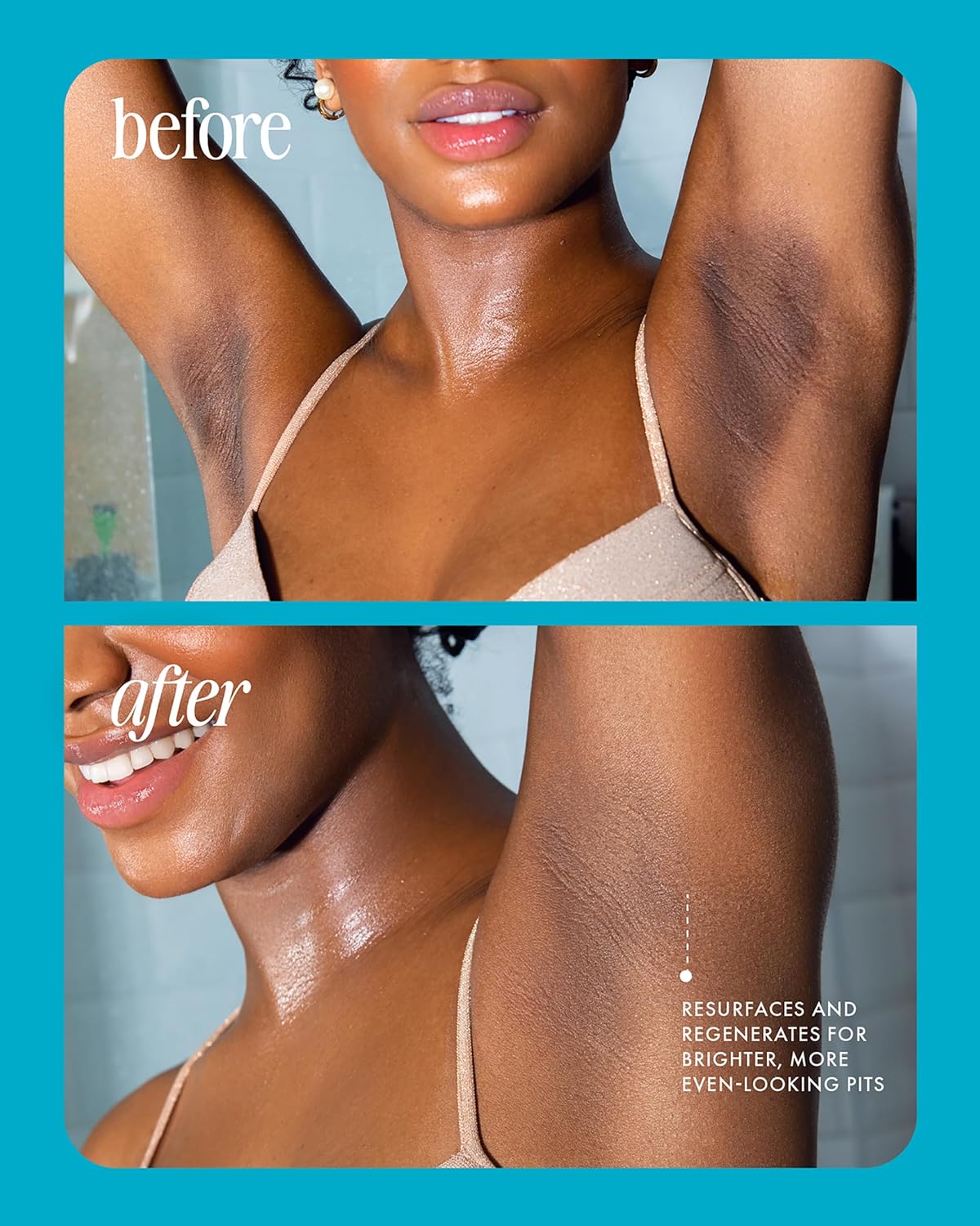 Glowvera – Pigment Body Correcting Serum