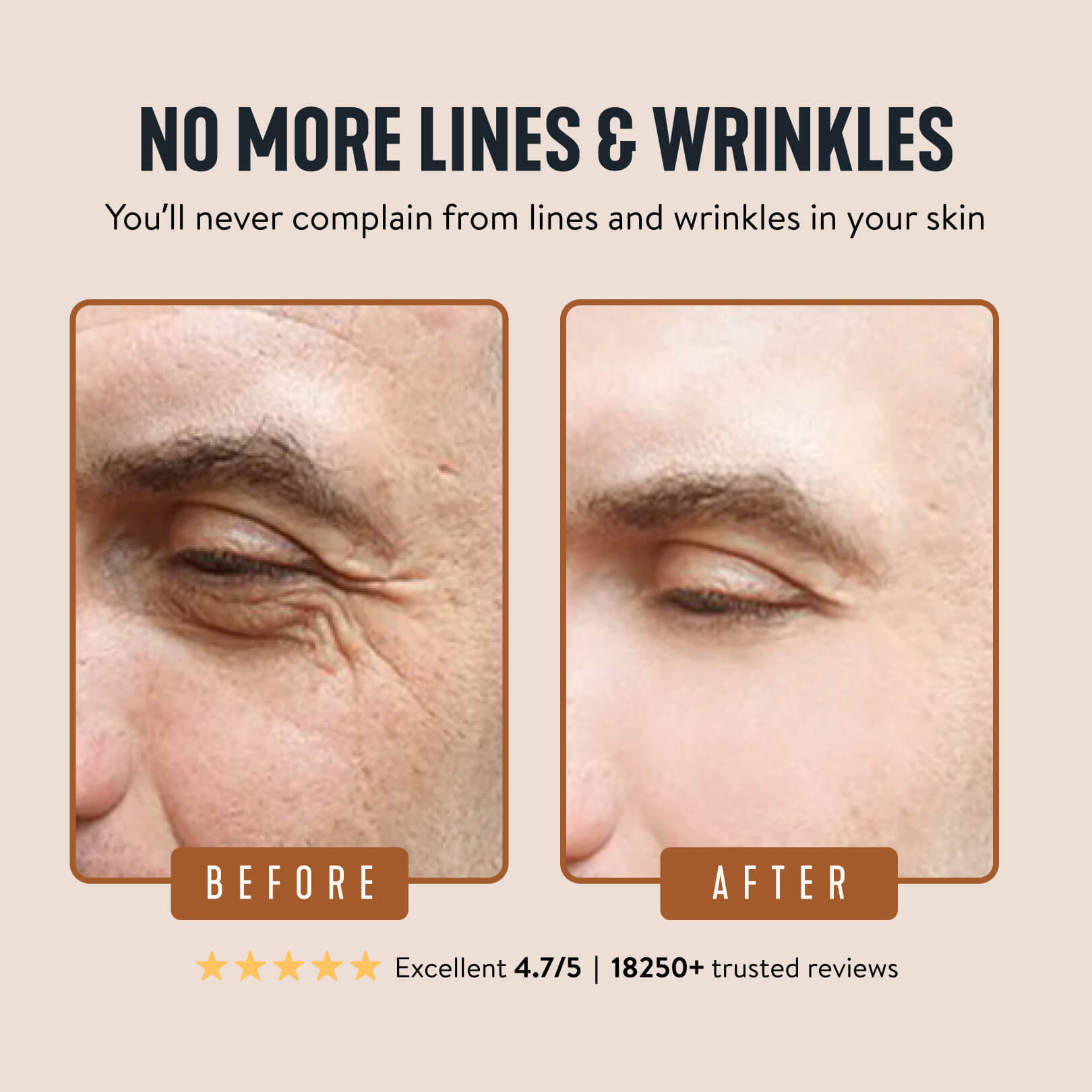 YouthForge – Nourishing Wrinkle Defense Face Balm