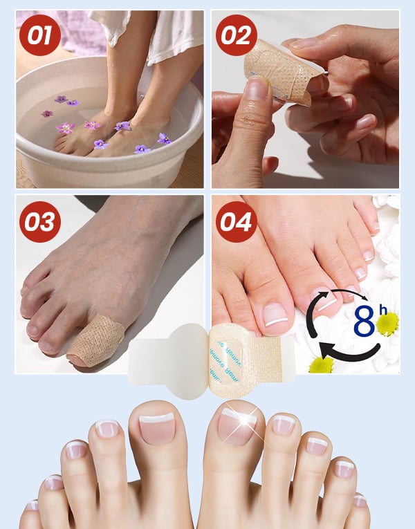 FungiCare – Advanced Nail Repair Patches