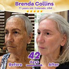 SkinRevive –  Biotin 10-in-1 Skin Restoration Cream