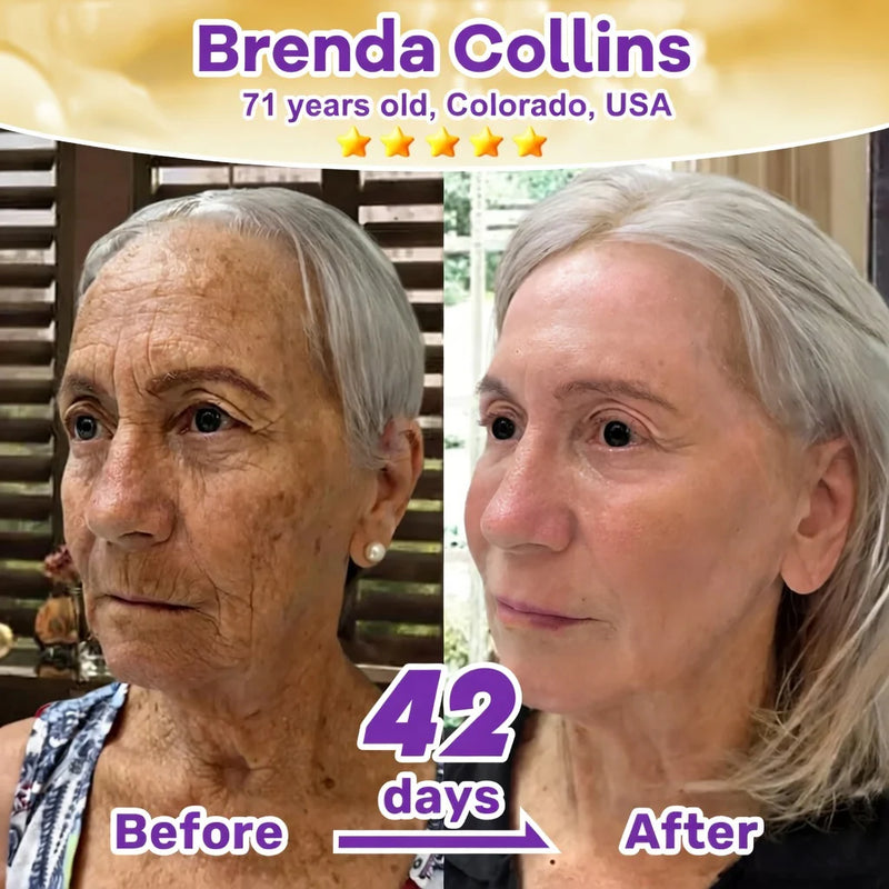 SkinRevive –  Biotin 10-in-1 Skin Restoration Cream