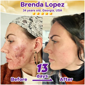 SkinRevive –  Biotin 10-in-1 Skin Restoration Cream