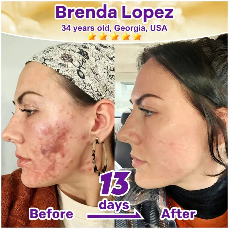 SkinRevive –  Biotin 10-in-1 Skin Restoration Cream