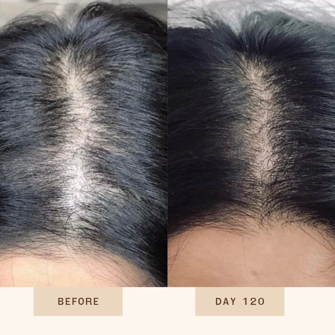 GrowHair – Proskire Anti-Grey Hair Serum