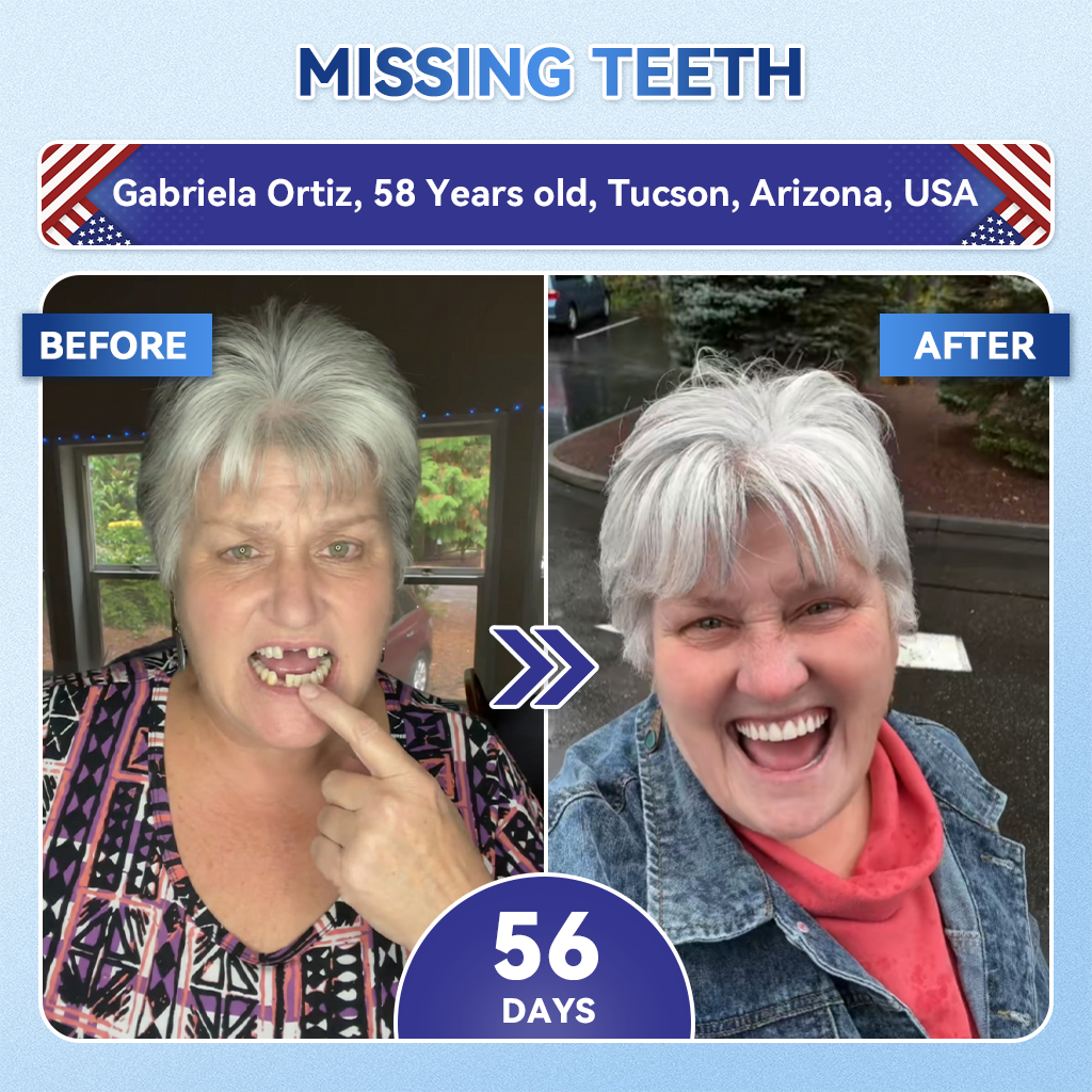 Dentafresh Pro – Whitening Repair Strips