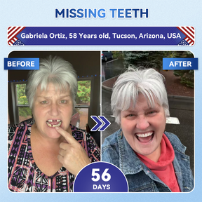 Dentafresh Pro – Whitening Repair Strips