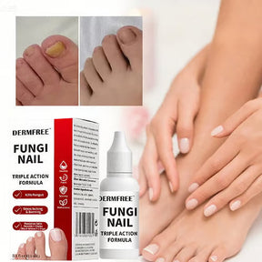 PureRoot – Extra Strength Toenail Treatment