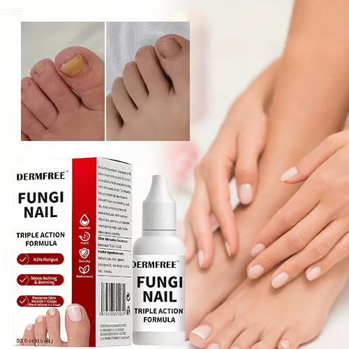 PureRoot – Extra Strength Toenail Treatment