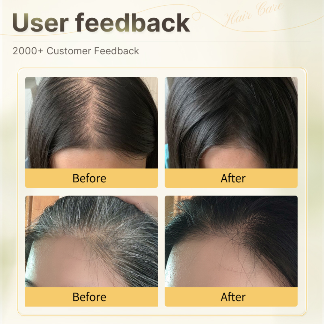 GrowHair – Proskire Anti-Grey Hair Serum