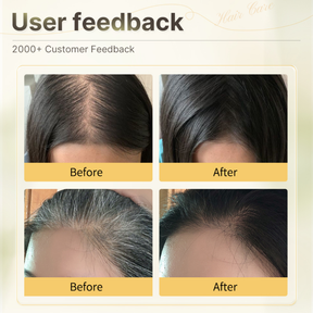 GrowHair – Proskire Anti-Grey Hair Serum