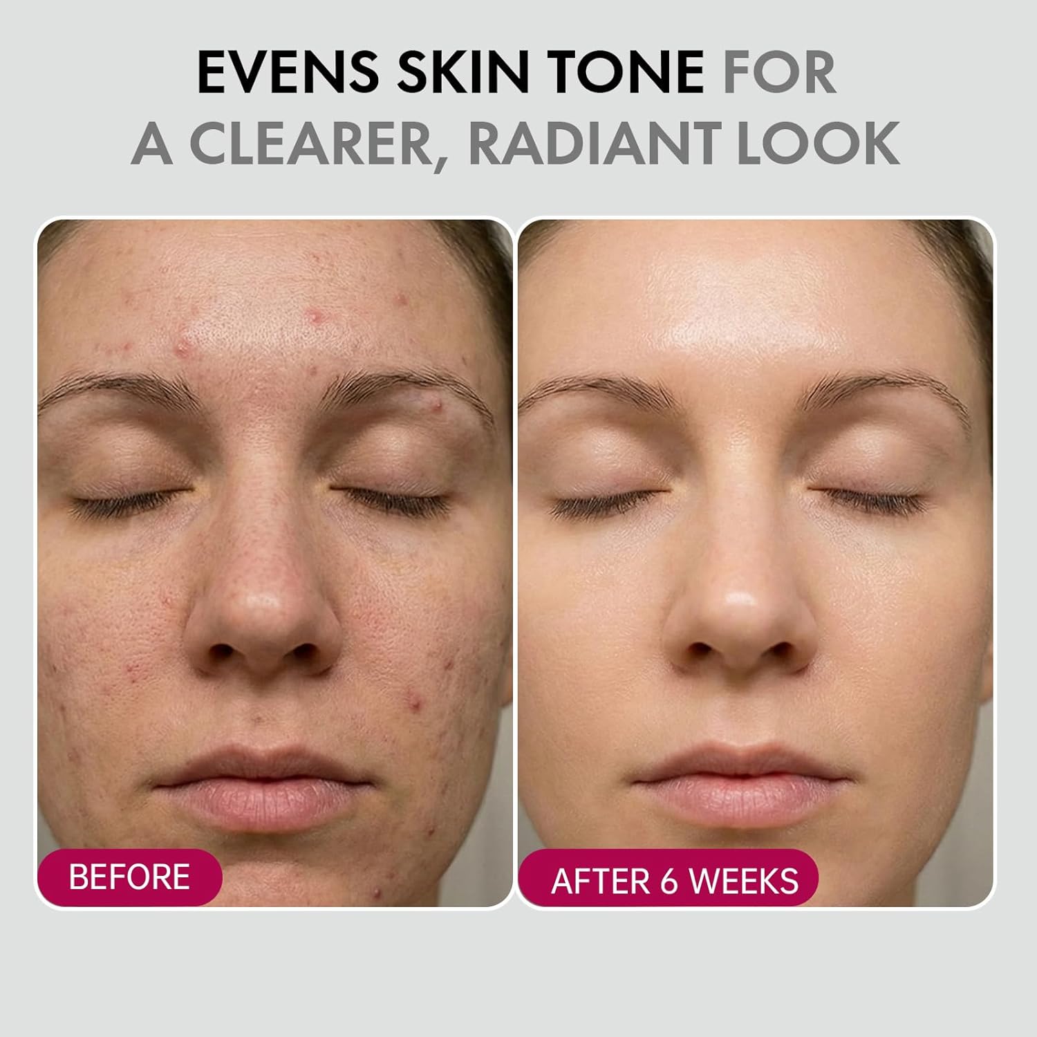 DermaGlow – Advanced Skin Renewing Treatment Cream