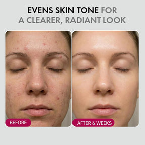 DermaGlow – Advanced Skin Renewing Treatment Cream