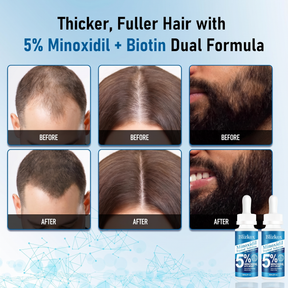 GrowthElite  – Biotin Infused Hair Regrowth Formula