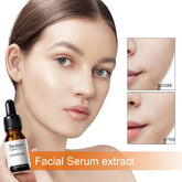 DermaYouth – Argireline Anti-Aging Formula