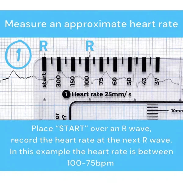 MediTrack – Professional ECG Assessment Pocket Guide