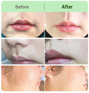 SkinEase – Smooth Finish Hair Removal Cream