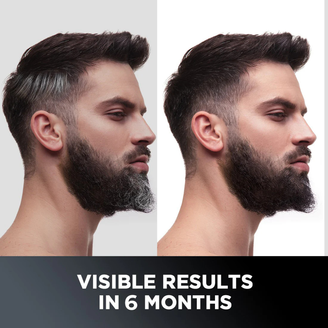 GrowHair – Proskire Anti-Grey Hair Serum