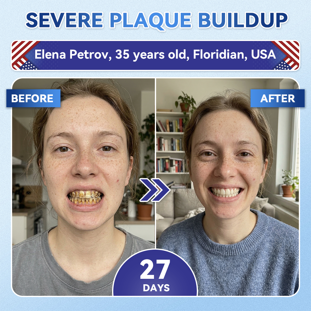 Dentafresh Pro – Whitening Repair Strips
