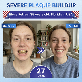 Dentafresh Pro – Whitening Repair Strips