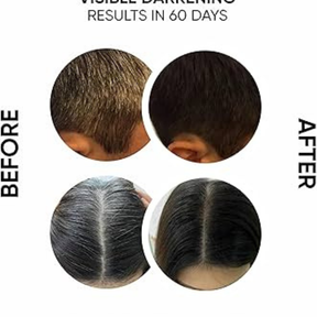GrowHair – Proskire Anti-Grey Hair Serum