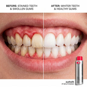 CleanAura – Breath Freshening Whitening Rinse