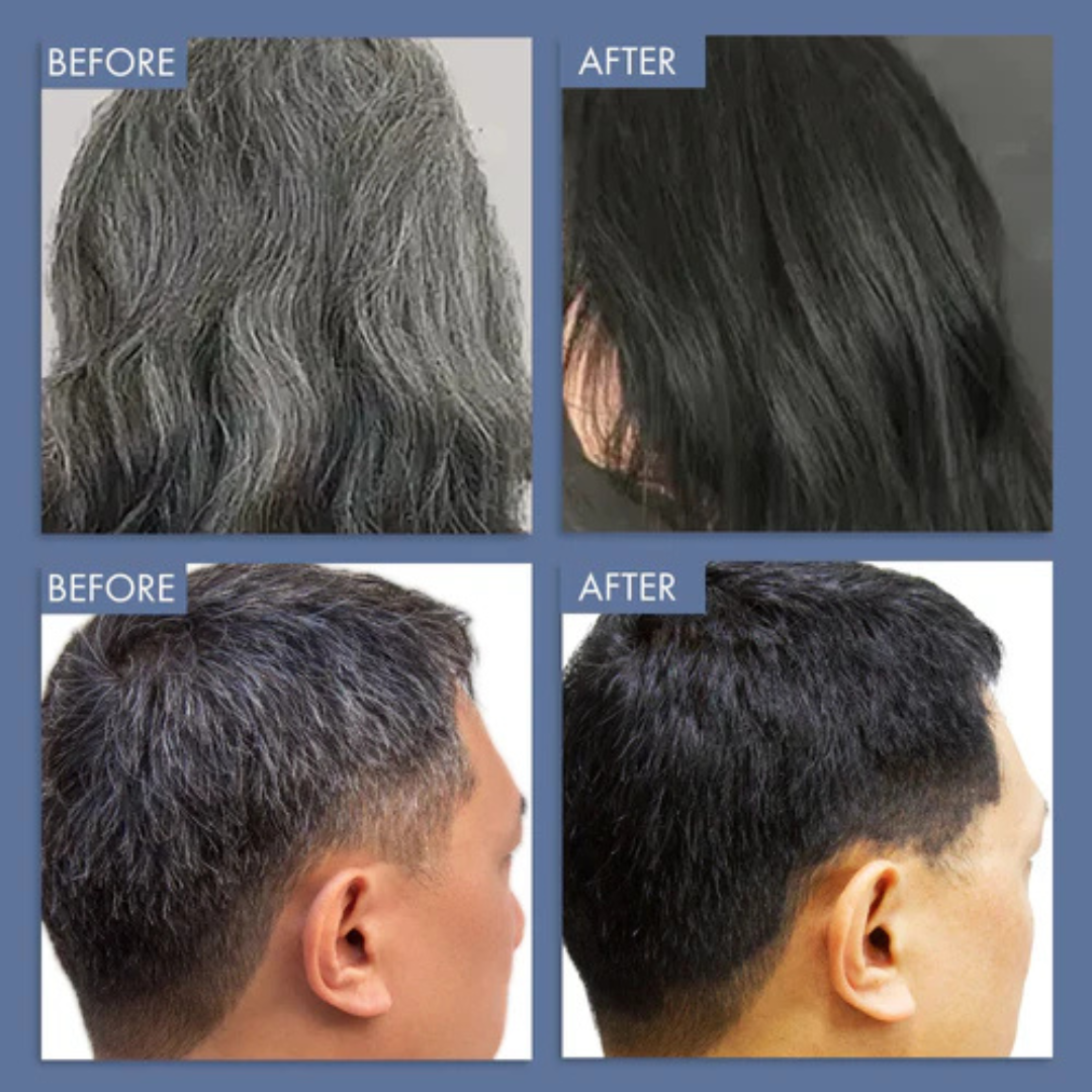 GrowHair – Proskire Anti-Grey Hair Serum