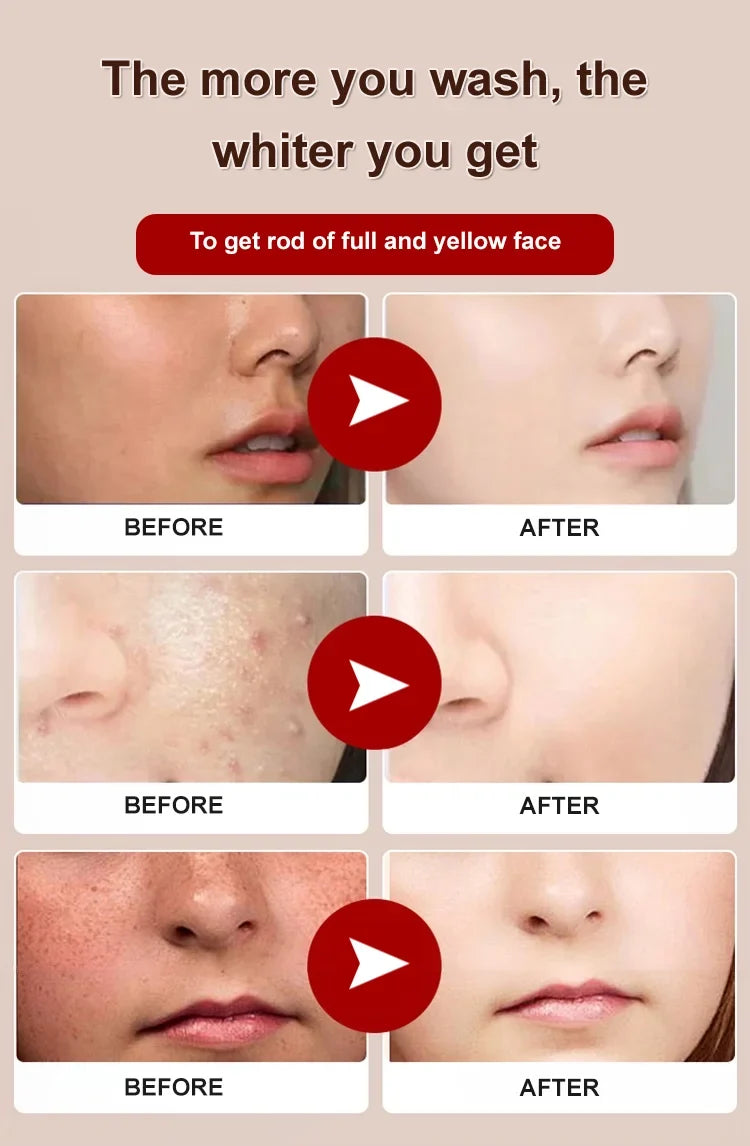 TitanClear – Intensive Purifying & Brightening Cleanser