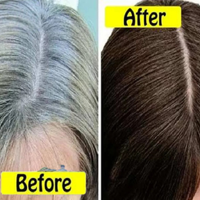 GrowHair – Proskire Anti-Grey Hair Serum