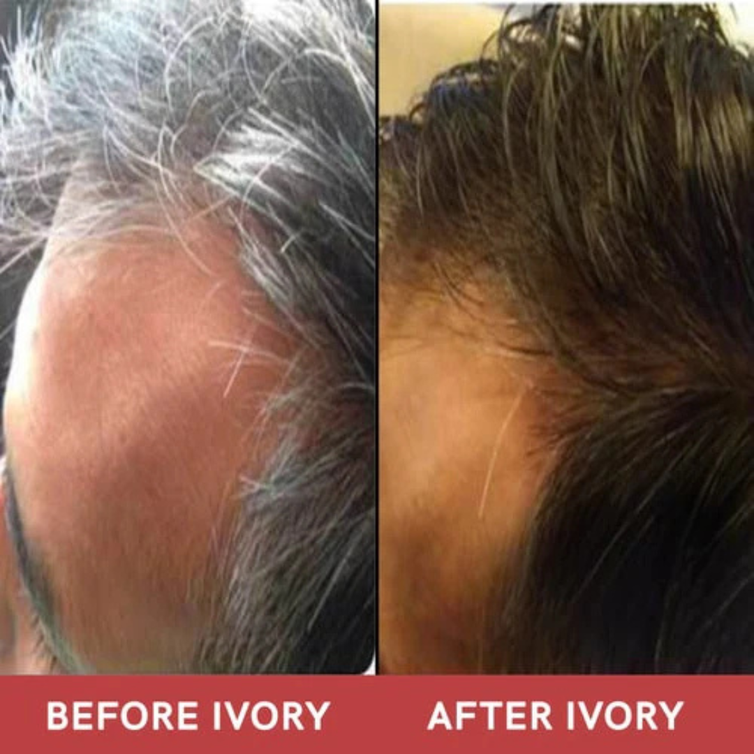 GrowHair – Proskire Anti-Grey Hair Serum