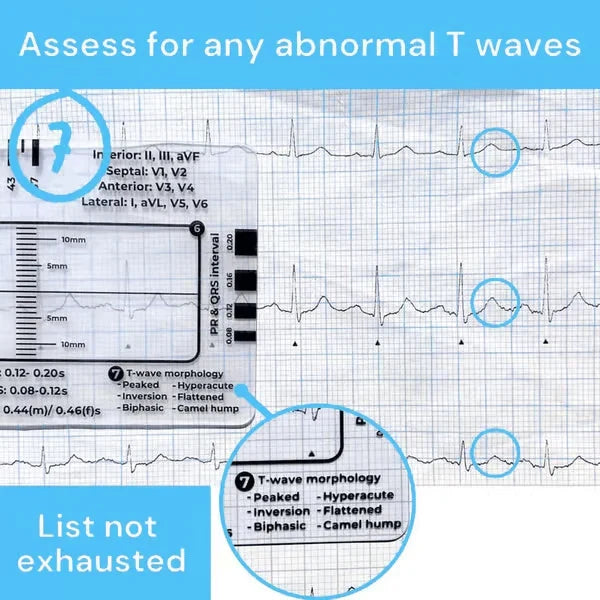 MediTrack – Professional ECG Assessment Pocket Guide