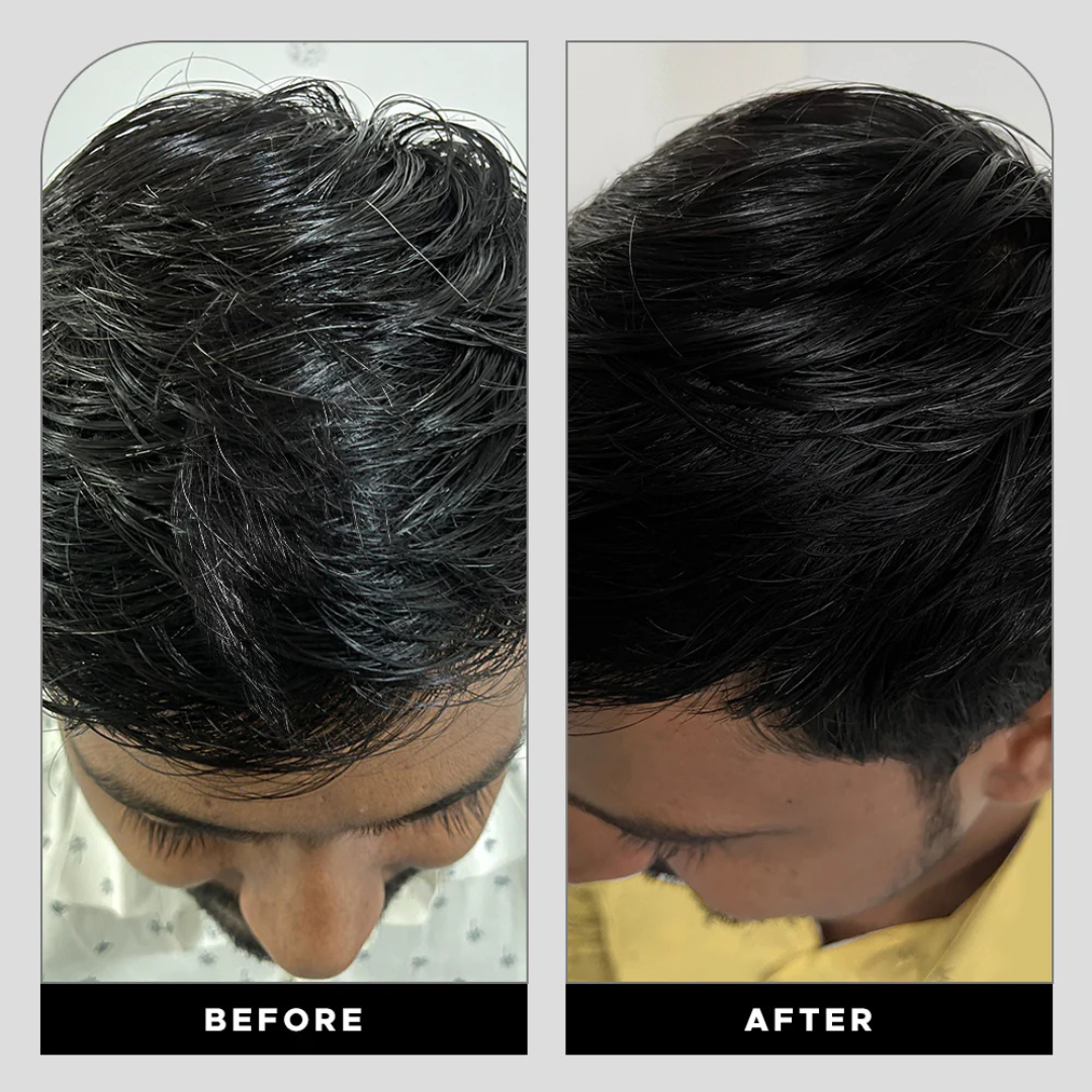 GrowHair – Proskire Anti-Grey Hair Serum
