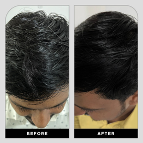GrowHair – Proskire Anti-Grey Hair Serum