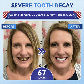 Dentafresh Pro – Whitening Repair Strips