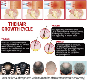HairLuxe – Multi Mode Hair Wellness  Cap