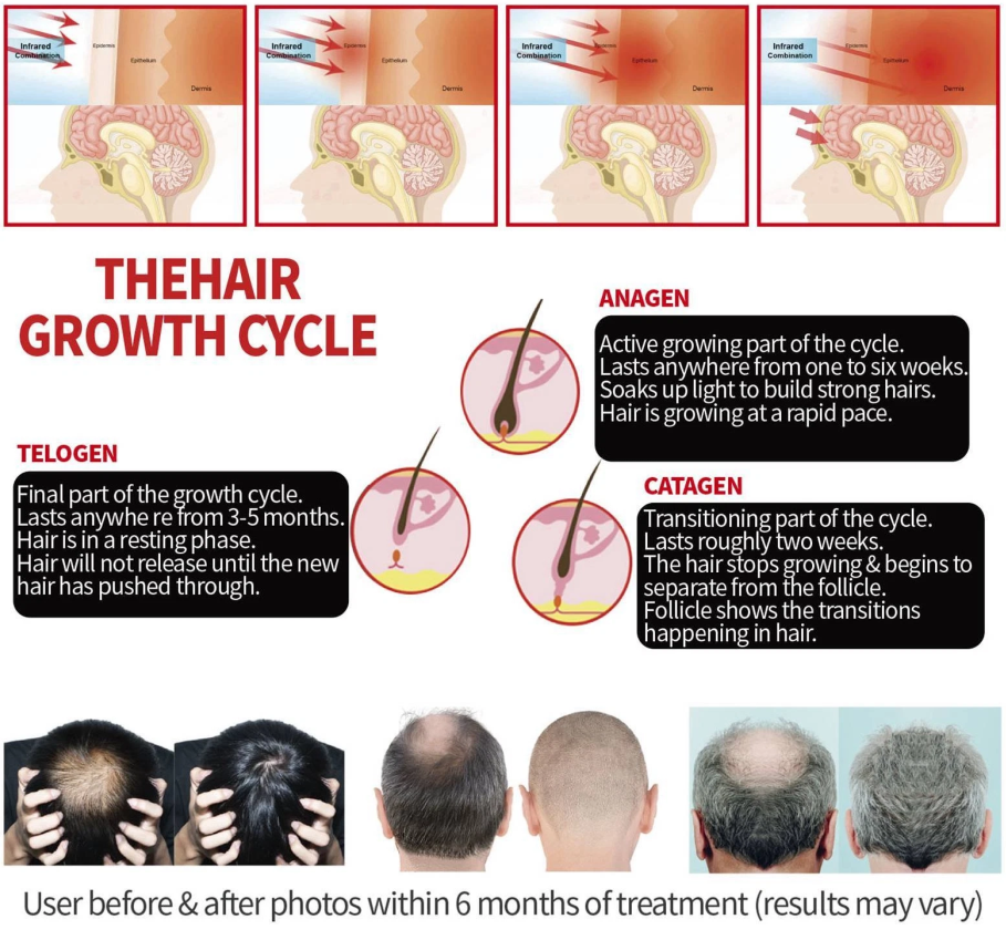 HairLuxe – Multi Mode Hair Wellness  Cap