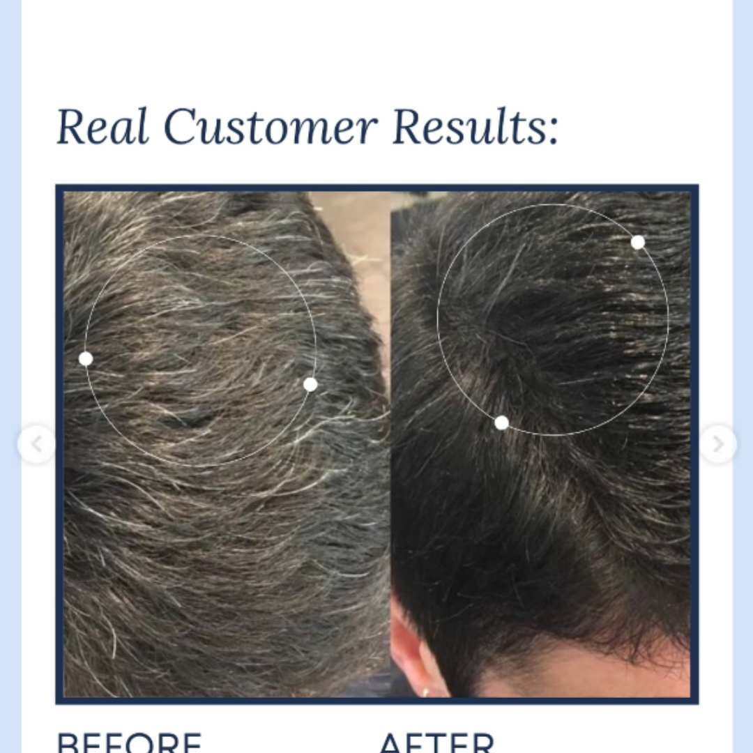 GrowHair – Proskire Anti-Grey Hair Serum